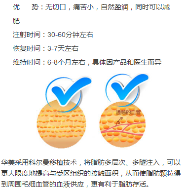 ��ƻ����