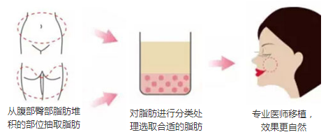 ��ƻ����