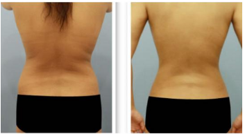 �Ͼ�������֬��������и�������?