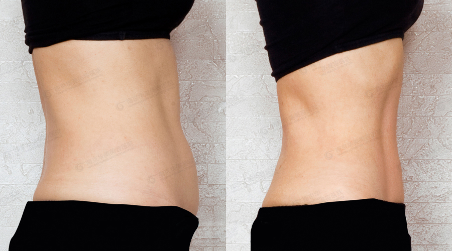 ������֬