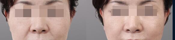 �Ͼ���ε����沿�����ƣ�