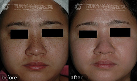 �沿��ȸ���Լ�����ʧ��