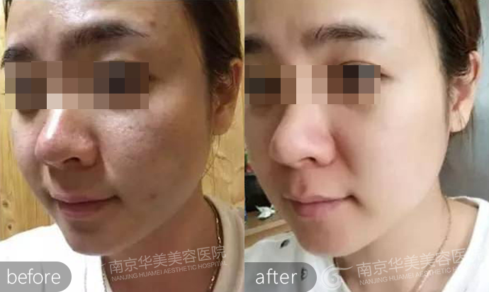 �Ͼ�ë�״�����С��